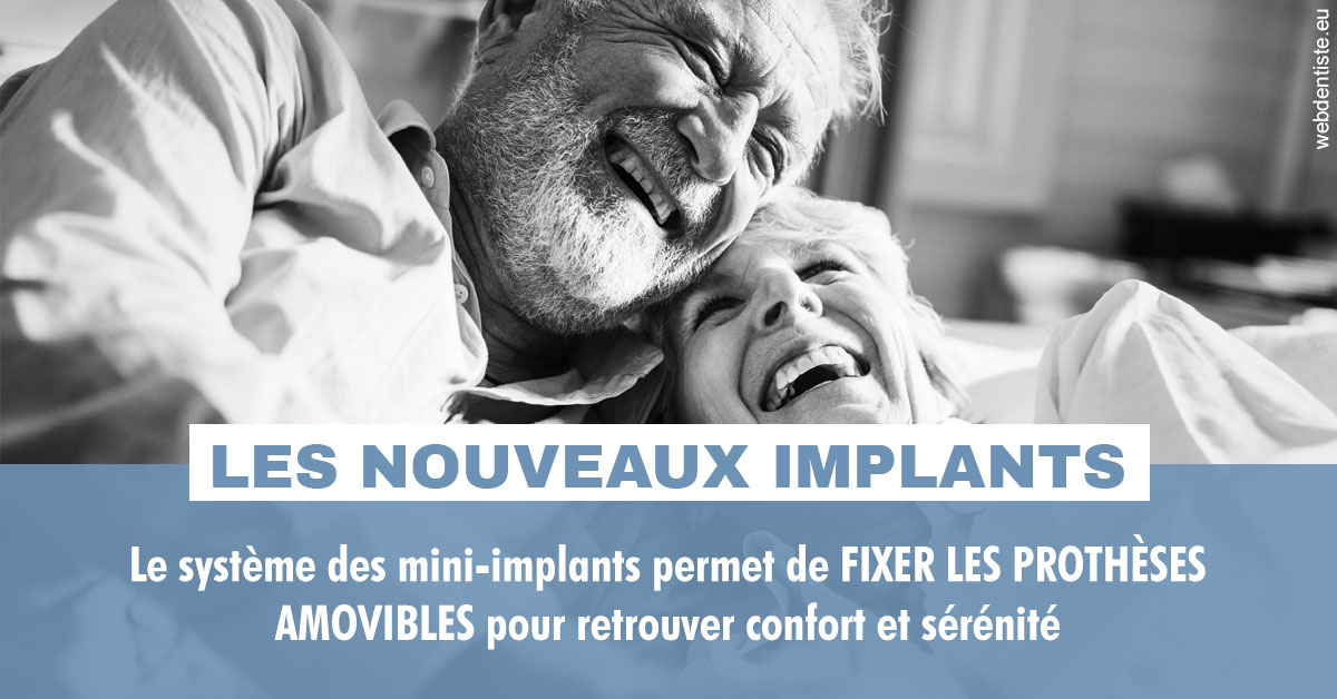 https://dr-laquille-sophie.chirurgiens-dentistes.fr/Les nouveaux implants 2