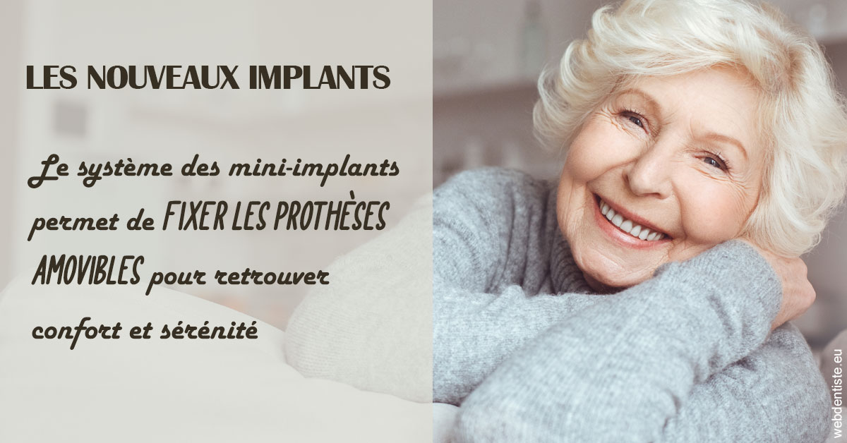 https://dr-laquille-sophie.chirurgiens-dentistes.fr/Les nouveaux implants 1