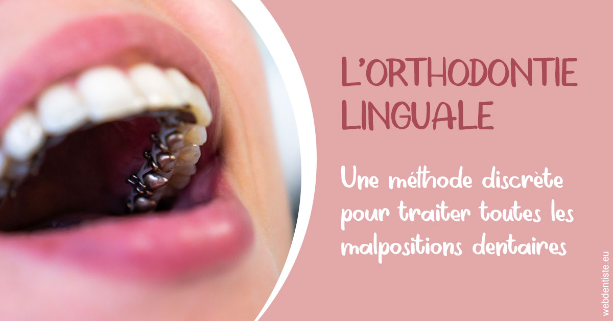 https://dr-laquille-sophie.chirurgiens-dentistes.fr/L'orthodontie linguale 2