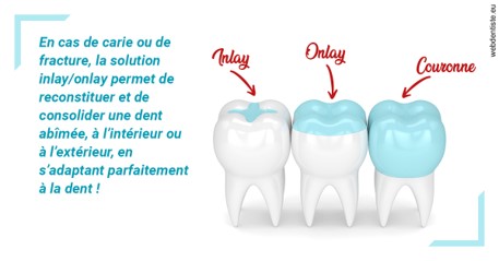 https://dr-laquille-sophie.chirurgiens-dentistes.fr/L'INLAY ou l'ONLAY