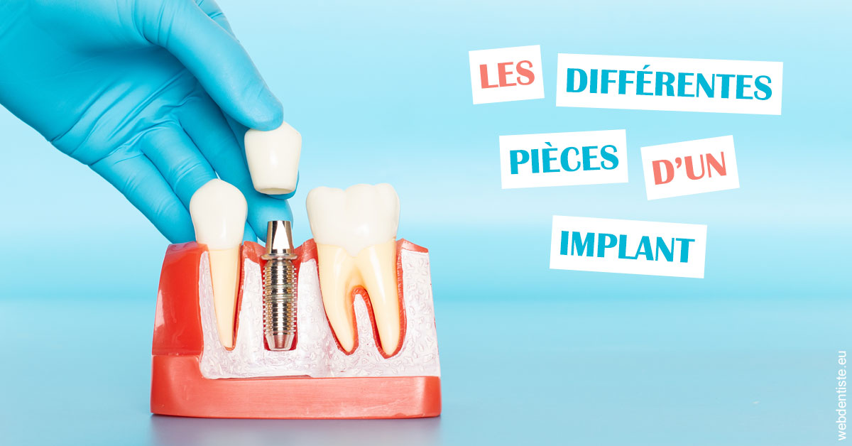 https://dr-laquille-sophie.chirurgiens-dentistes.fr/Les différentes pièces d’un implant 2
