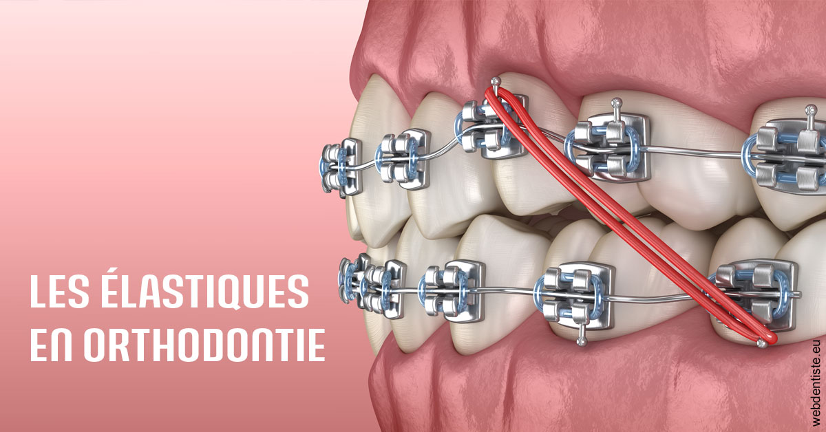 https://dr-laquille-sophie.chirurgiens-dentistes.fr/Elastiques orthodontie 2